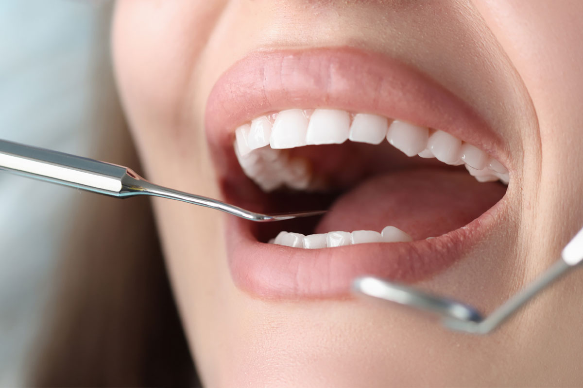 ¿Cada cuánto debo ir al dentista? Recomendaciones clave para mantener una sonrisa sana