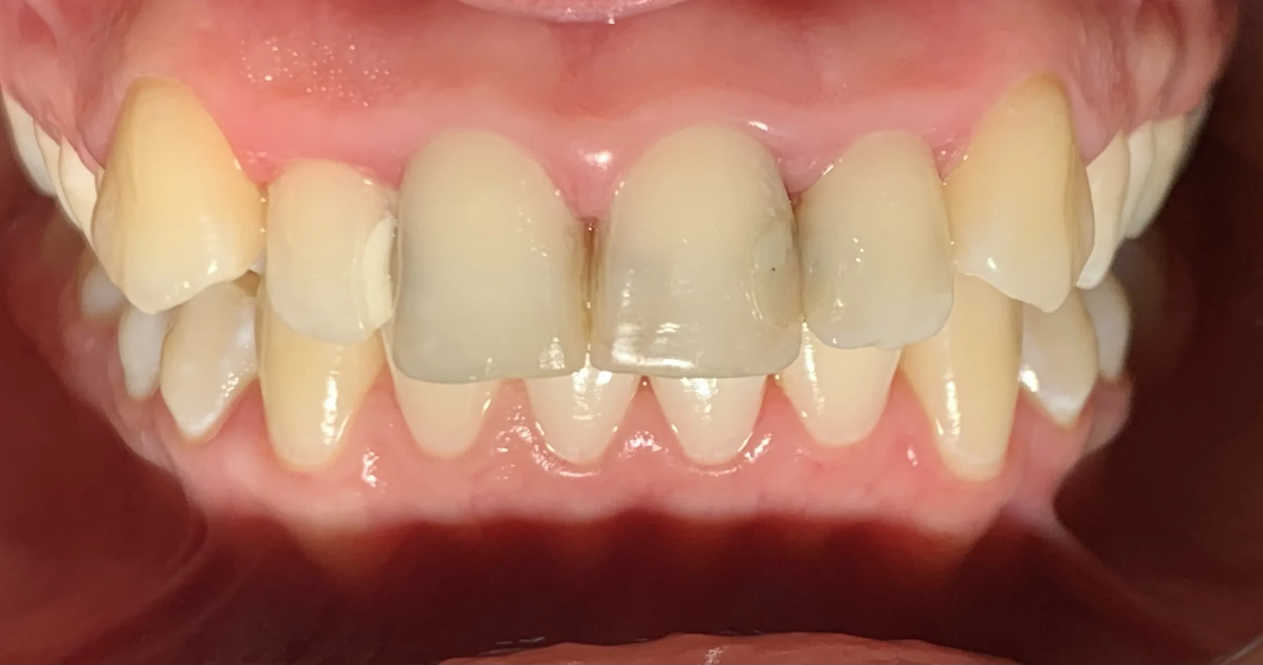 Restauracion en recina1