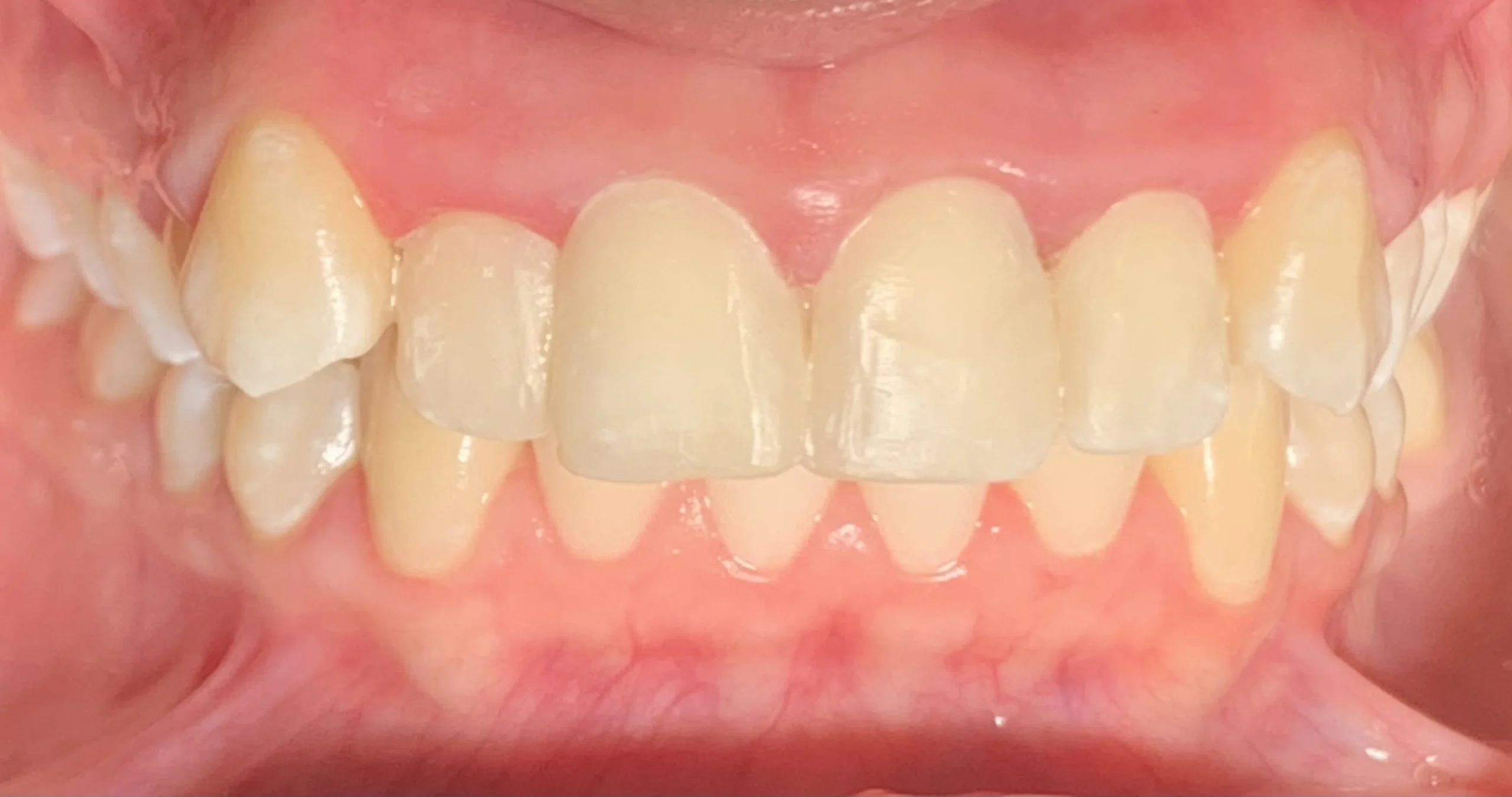 Restauracion en recina2